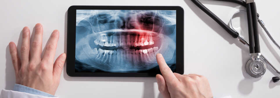 Dr Ryan Gilreath Full-Mouth Makeover