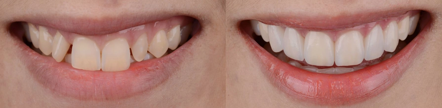 before and after picture